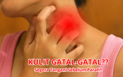 Kulit Gatal & Infeksi